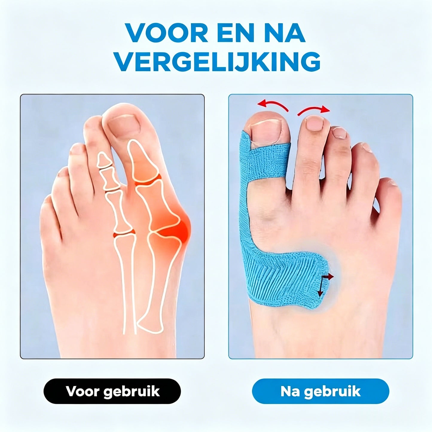 ✨Draag al je favoriete schoenen – zonder bunionpijn! 👠💃