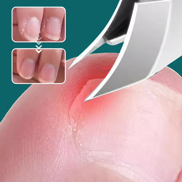 Anti-slash schuine rand nagelknipper 3-delige set